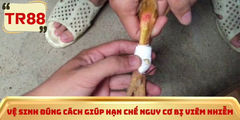 Vệ sinh đúng cách giúp hạn chế nguy cơ bị viêm nhiễm